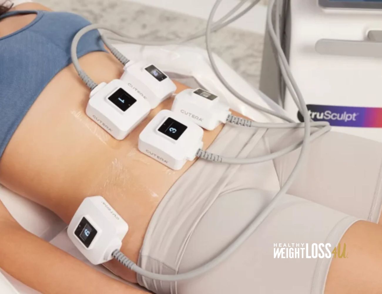 non-surgical fat reduction with trusculpt